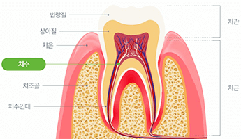 치아모양 이미지 치수의 위치를 표시