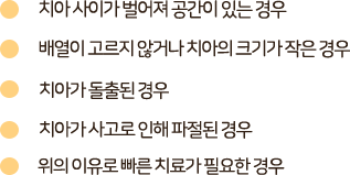 치아 사이가 벌어져 공간이 있는 경우 배열이 고르지 않거나 치아의 크기가 작은경우 치아가 돌출된 경우 치아가 사고로 인해 파절된 경우 위의 이유로 빠른 치료가 필요한 경우